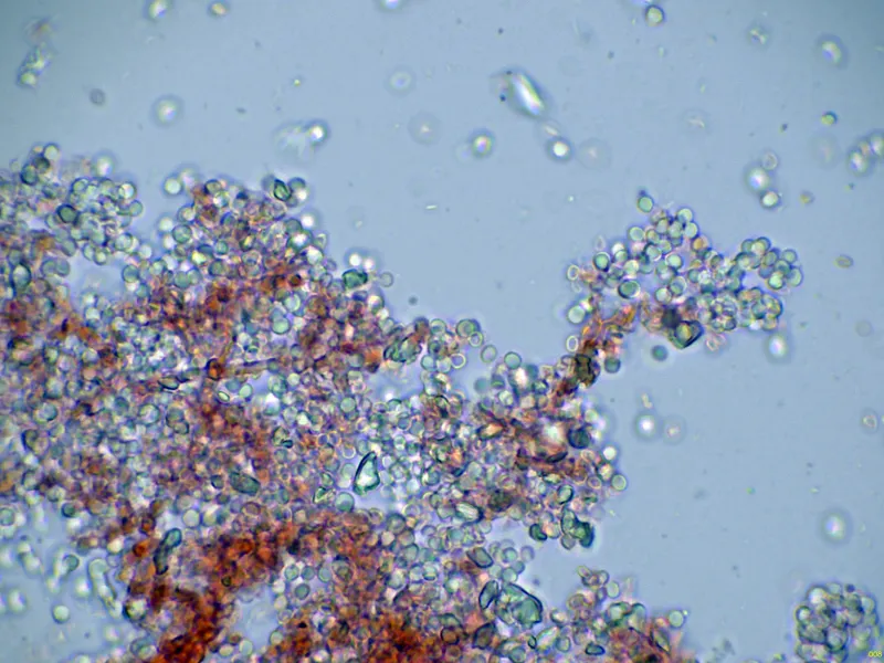 Beauveria bassiana 10 - Hifa conidiogena-008